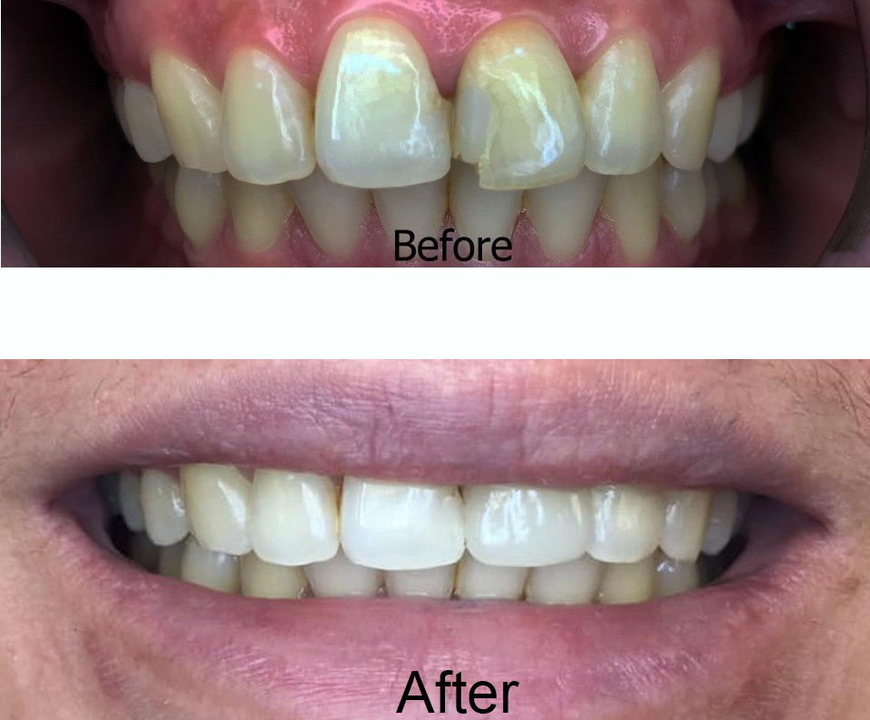 Real smiles. Real results.