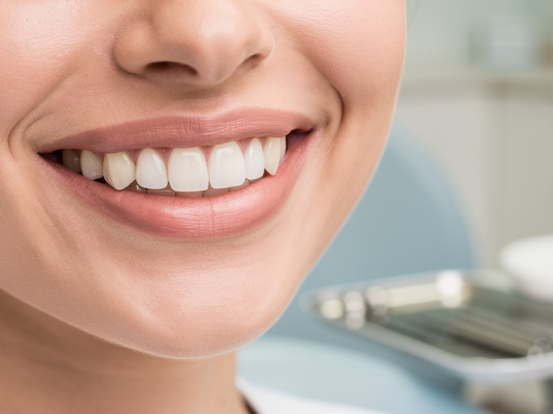 how-to-choose-the-right-cosmetic-dentist-for-veneers