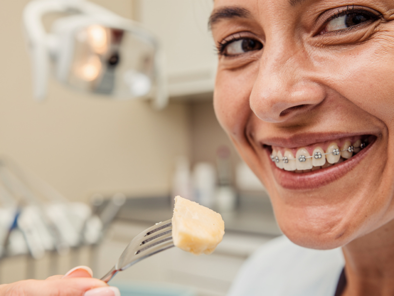 master-complete-mouth-dental-implants-your-step-by-step-guide
