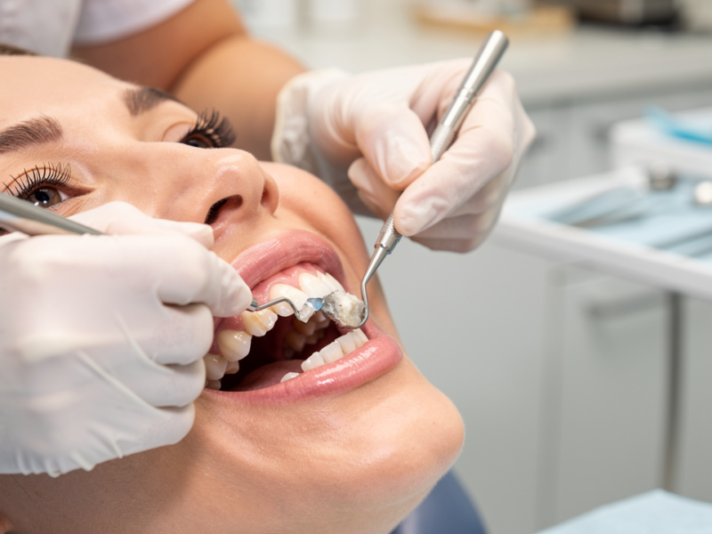 master-deep-cleaning-dental-steps-benefits-and-aftercare-tips