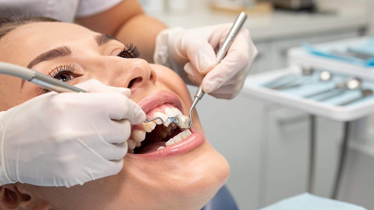 master-deep-cleaning-dental-steps-benefits-and-aftercare-tips