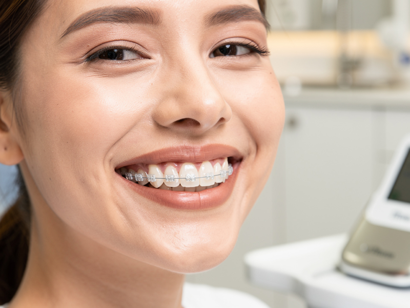 master-invisalign-dental-coverage-essential-insights-for-patients