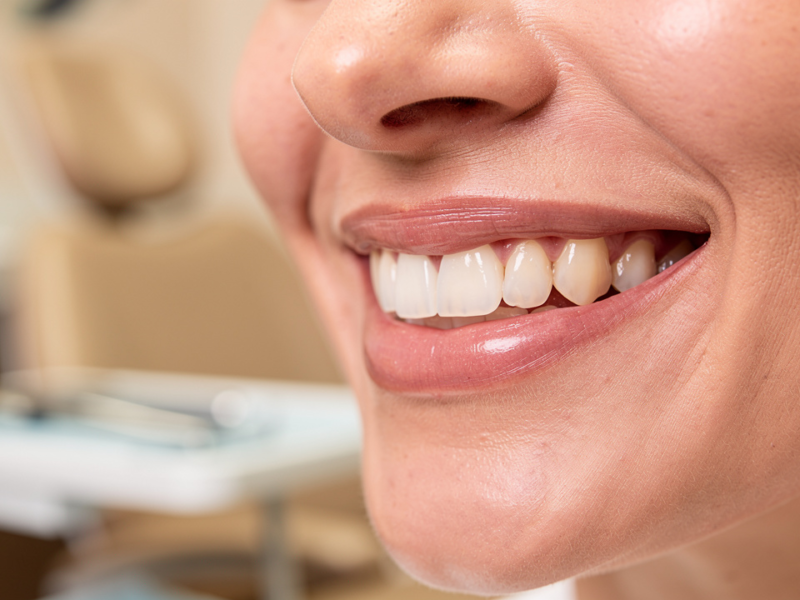 choose-the-right-tooth-bridge-a-step-by-step-guide