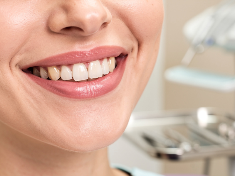 choose-the-right-tooth-bridge-material-a-step-by-step-guide