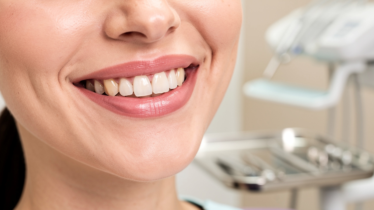 choose-the-right-tooth-bridge-material-a-step-by-step-guide