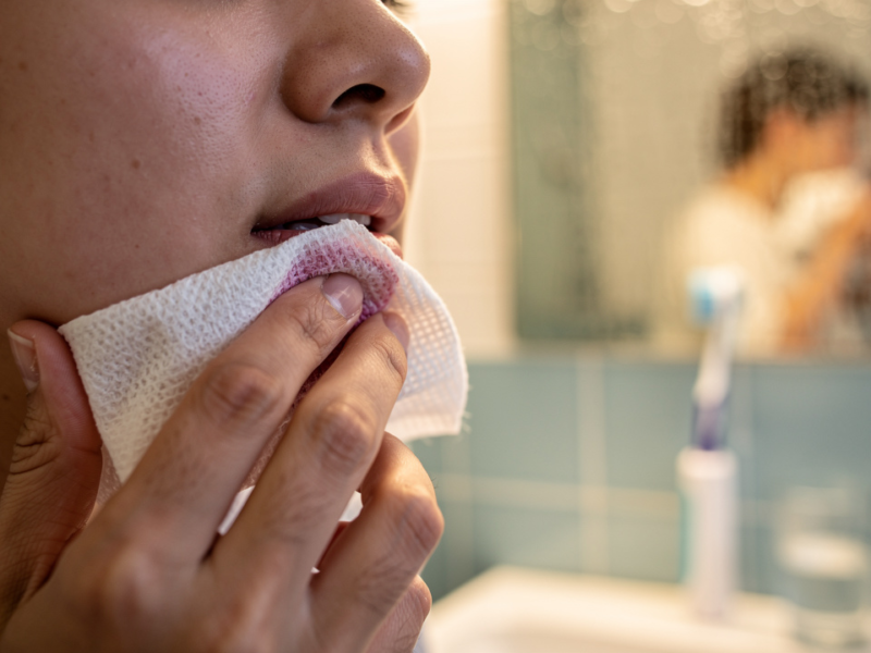 understanding-blood-clot-in-wisdom-tooth-extraction-a-patients-guide