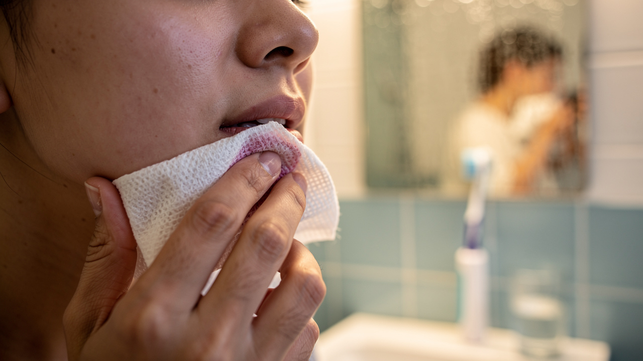 understanding-blood-clot-in-wisdom-tooth-extraction-a-patients-guide