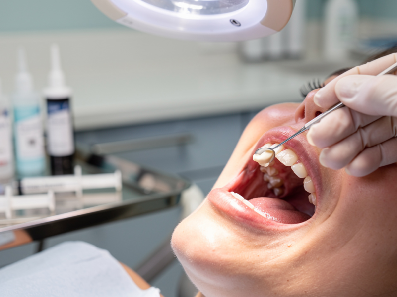 what-is-dental-cement-filling-importance-types-and-concerns