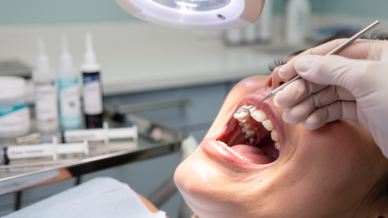what-is-dental-cement-filling-importance-types-and-concerns