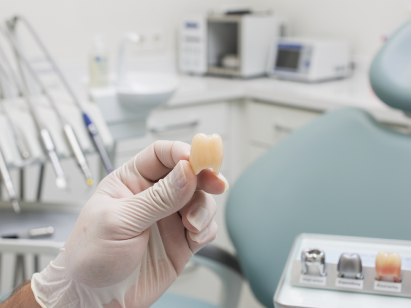 comparing-costs-of-replacing-a-dental-crown-in-house-vs-out-of-network