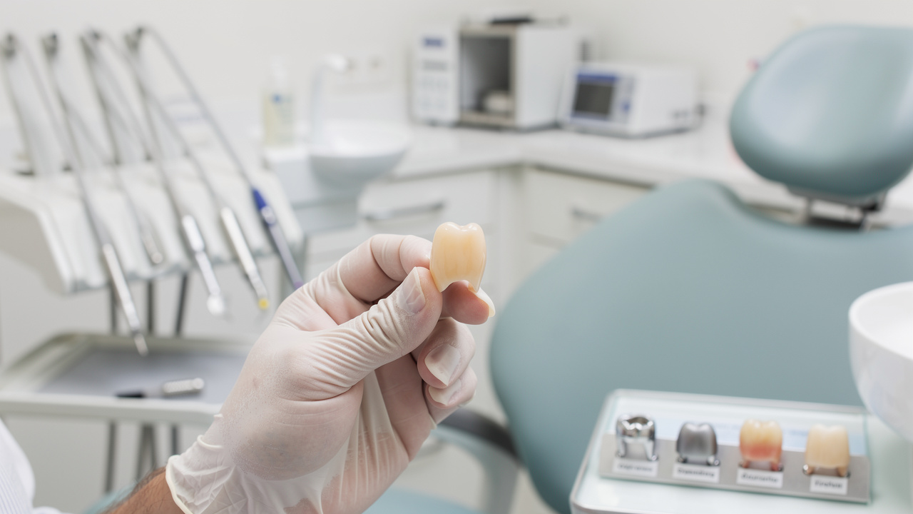 comparing-costs-of-replacing-a-dental-crown-in-house-vs-out-of-network