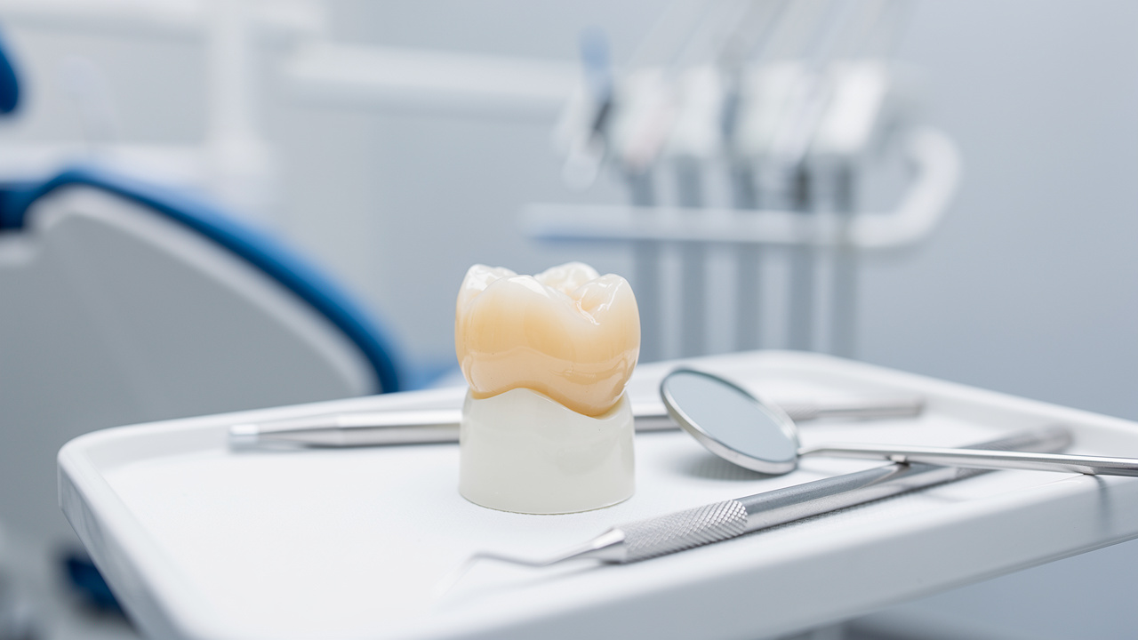 dental-crown-cost-average-vs-alternatives-what-you-need-to-know