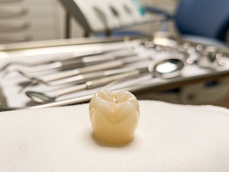 manage-dental-pain-after-a-crown-essential-steps-for-relief