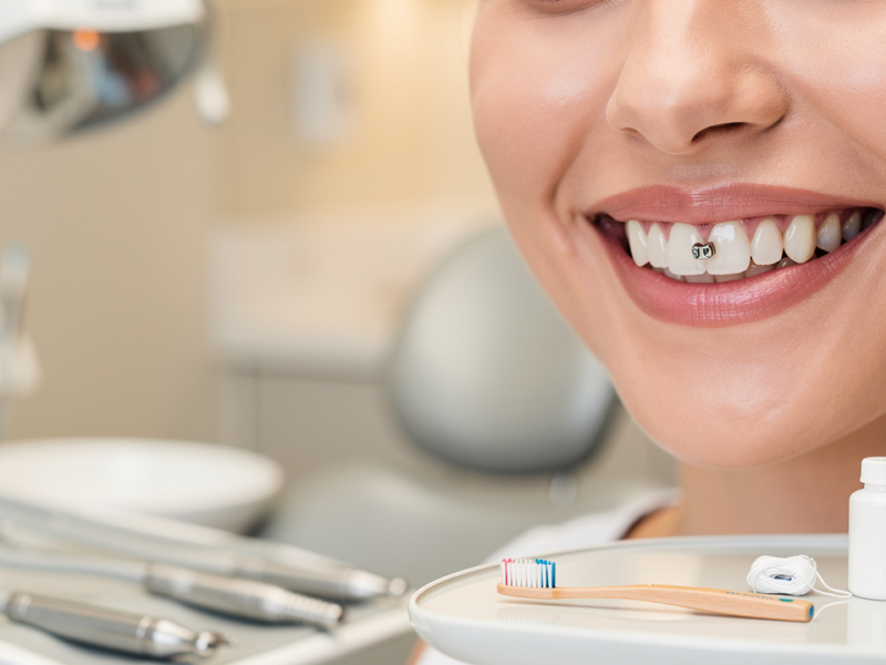 understanding-1-tooth-bridge-cost-factors-and-financial-options