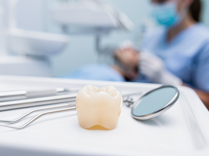 understanding-cracks-in-dental-crowns-causes-and-solutions