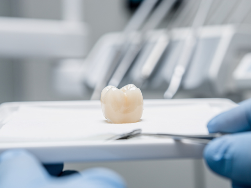 understanding-dental-crown-soreness-causes-and-treatment-steps