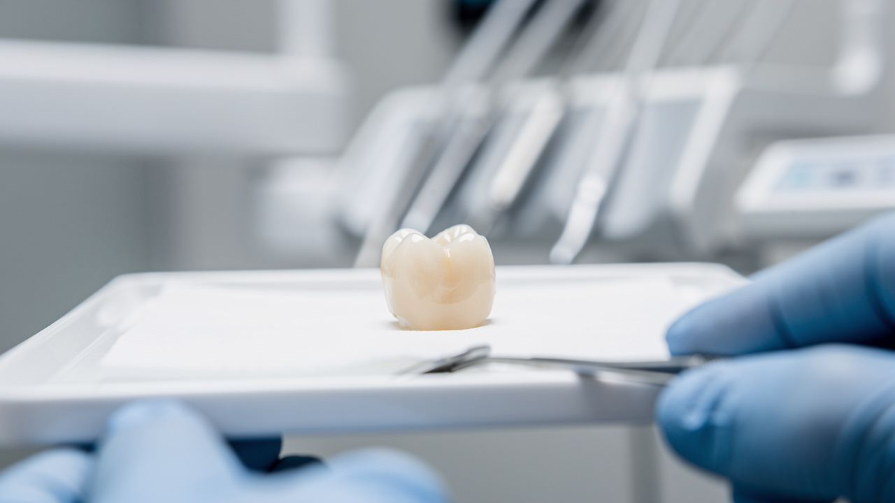 understanding-dental-crown-soreness-causes-and-treatment-steps