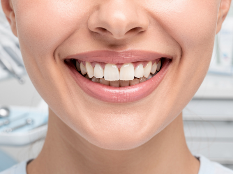 understanding-permanent-tooth-bridge-cost-factors-and-options-explained